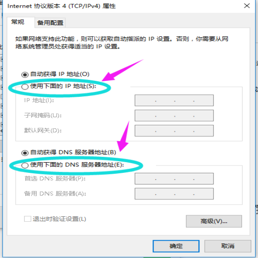 設置IP地址
